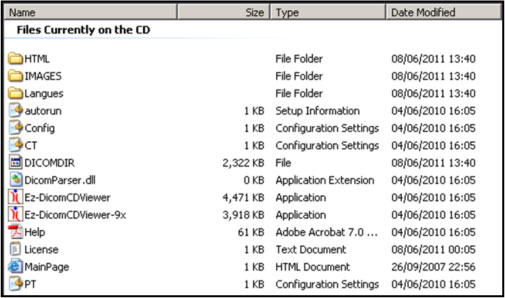 The EZ-Dicom viewer will launch and images contained on the disc can ...