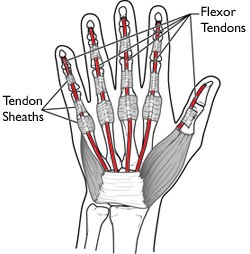 Diagramofthetendons.jpg — Chelsea and Westminster Hospital NHS ...